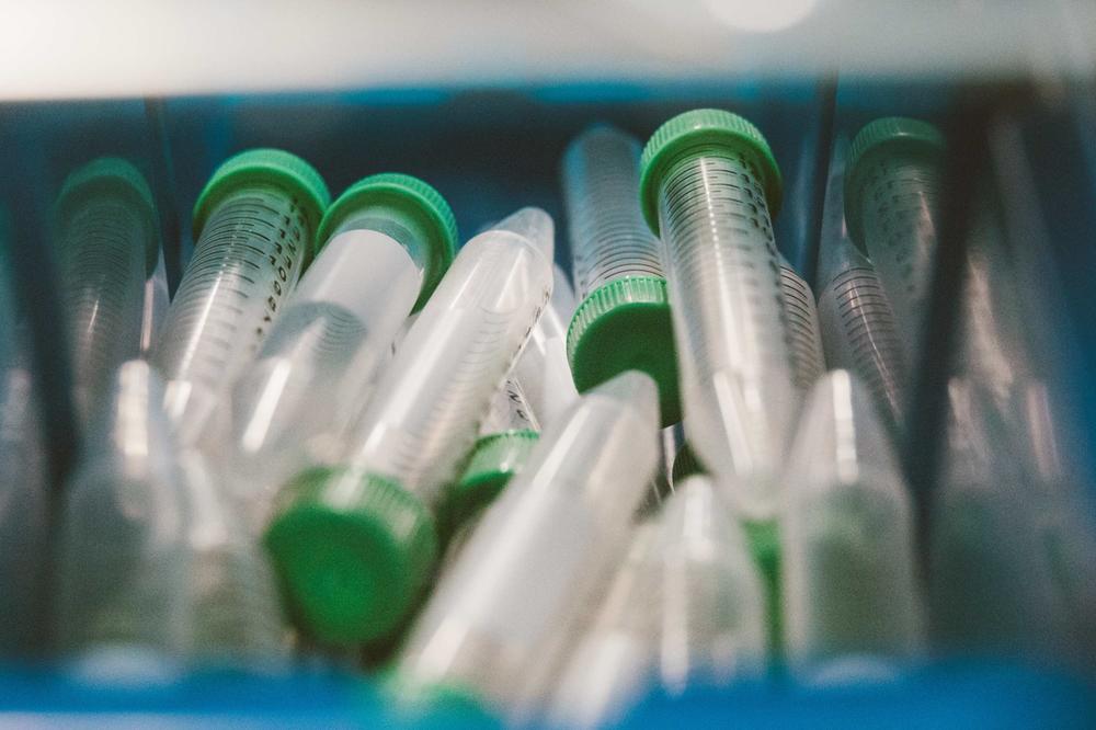 Mehrere leere Kunststoff-Reagenzgläser mit grünen Schraubverschlüssen liegen ungeordnet in einer blauen Box, bereit für den Einsatz im Labor.