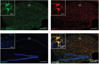 Microglia in a novel mouse model