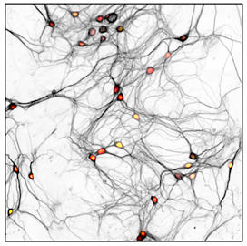 Freund-in-Brain