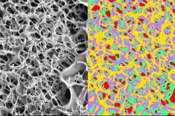 Raster-Elektronenmikroskopische Abbildung von synthetischem Schleim, analysiert mit KI